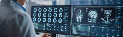 Oggetto: Scuola di Specializzazione in Fisica medica dell’Università di Padova 2022 per residenti in TN e BZ